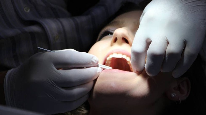 Tratamiento de carillas dentales