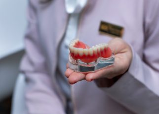 Implantes dentales