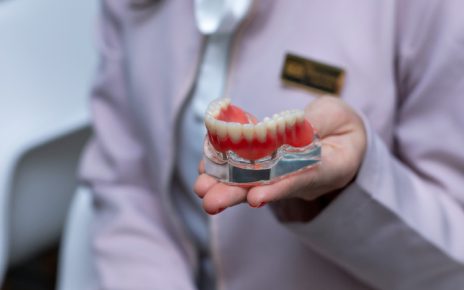 Implantes dentales
