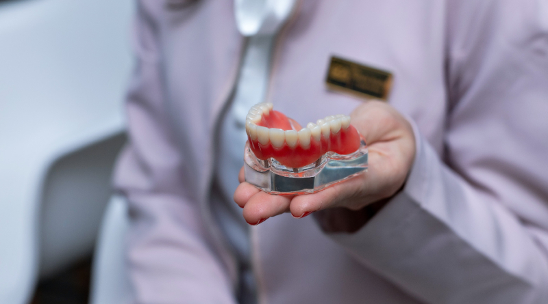 Implantes dentales
